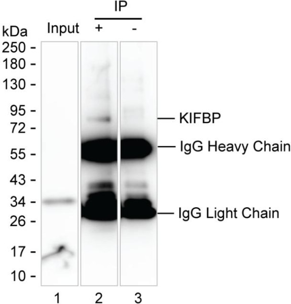 Anti-KIFBP