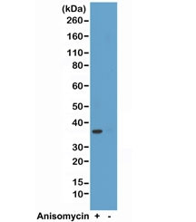 Anti-phospho-p38 MAPK (Thr180/Tyr182), clone RM243 (recombinant antibody)