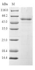 Pre-mRNA-splicing factor SPF27 (BCAS2), human, recombinant