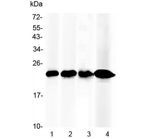 Anti-RBP4 / Retinol Binding Protein 4