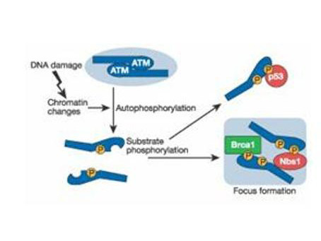 Anti-phospho-ATM Protein Kinase (Ser1981)