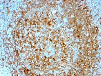 Anti-CD74(BU45), CF568 conjugate, 0.1mg/mL