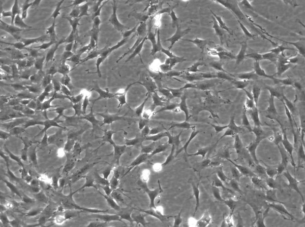 Wilms3 Cells