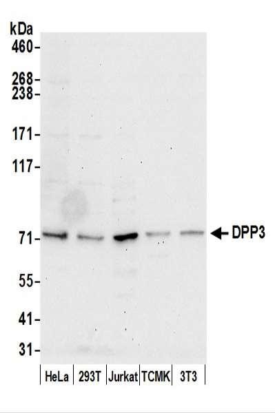 Anti-DPP3