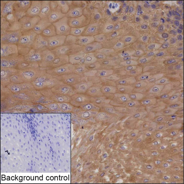 Anti-SPINT1