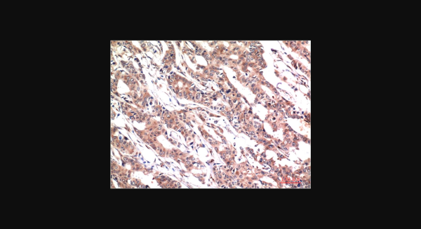 Anti-Phospho-Stat3 (Y705) (1E9), monoclonal