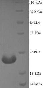 Immunogenic protein MPT64 (mpt64), Mycobacterium tuberculosis, recombinant