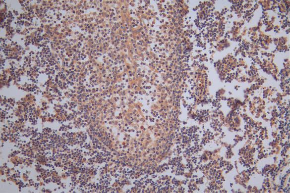 Anti-TK1 Recombinant Monoclonal, clone 15A5