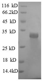 Laminin subunit beta-2 (LAMB2), partial, recombinant human