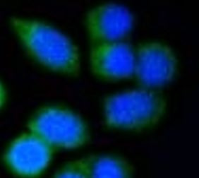 Anti-ARPC5 / p16 ARC
