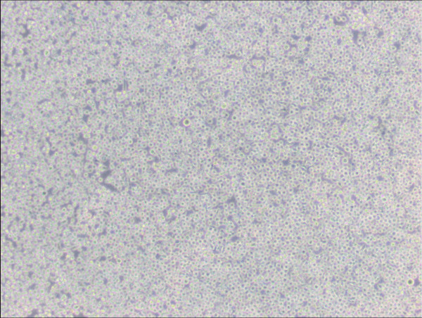 6T-CEM Cells