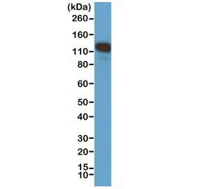 Anti-CD146, clone RM249 (recombinant antibody)
