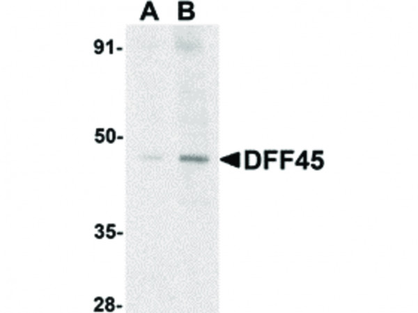 Anti-DFF45