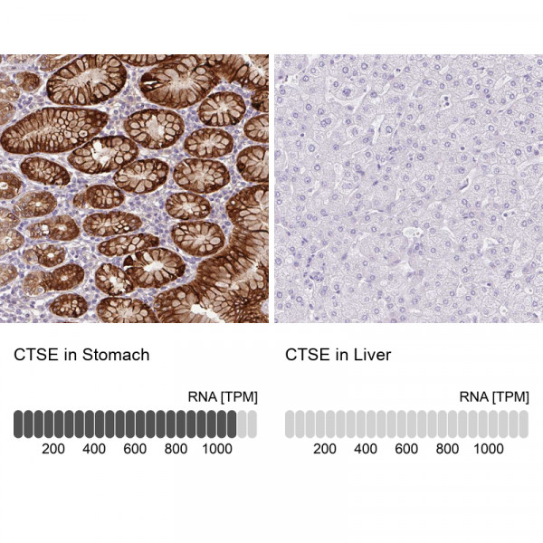 Anti-CTSE