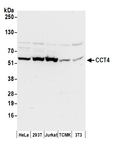 Anti-CCT4