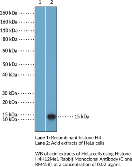 Anti-Histone H4K12Me1 Rabbit (Clone RM458)