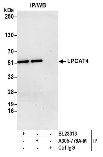 Anti-LPCAT4