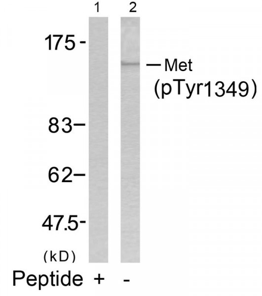 Anti-phospho-Met (Tyr1349)