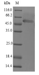 LIM domain-binding protein 3 (LDB3), human, recombinant