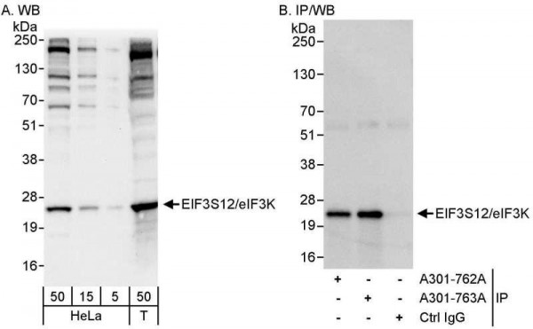 Anti-eIF3K/EIF3S12