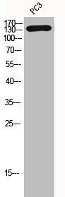 Anti-HDAC7