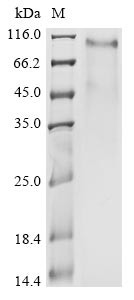 Spike glycoprotein (S), partial, human coronavirus HKU1, recombinant