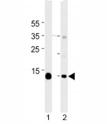Anti-Myoglobin, clone 444CT19.2.1