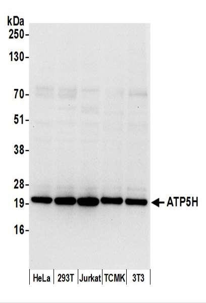 Anti-ATP5H