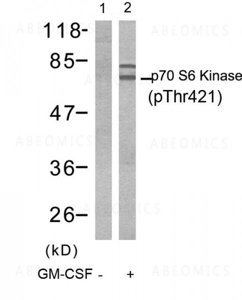 Anti-phospho-p70 S6 Kinase (Thr421)