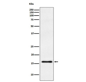 Anti-Gamma Synuclein / SNCG, clone ADEE-19