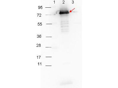 Anti-Surface Lipoprotein p27