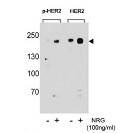 Anti-HER2 (ERBB2) (phospho-S1151)