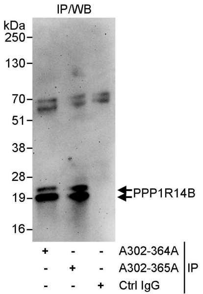 Anti-PPP1R14B