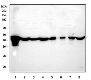 Anti-b-Actin / Beta Actin