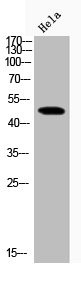 Anti-Phospho-GSK3B (S9)