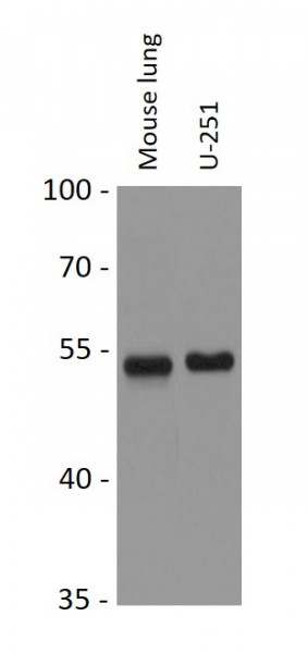 Anti-STK24 / MST3