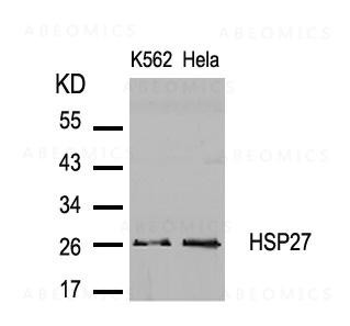 Anti-HSP27 (Ab-82)
