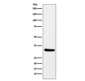 Anti-CRALBP / RLBP1, clone AEFB-18