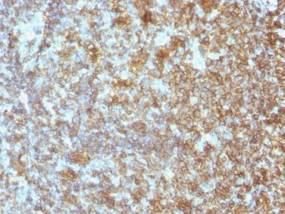 Anti-CD45 / LCA (Leucocyte Marker)(Clone: SPM496)