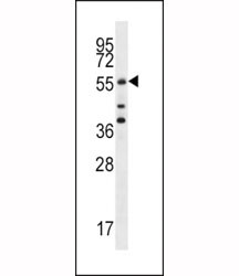 Anti-Cdc25A