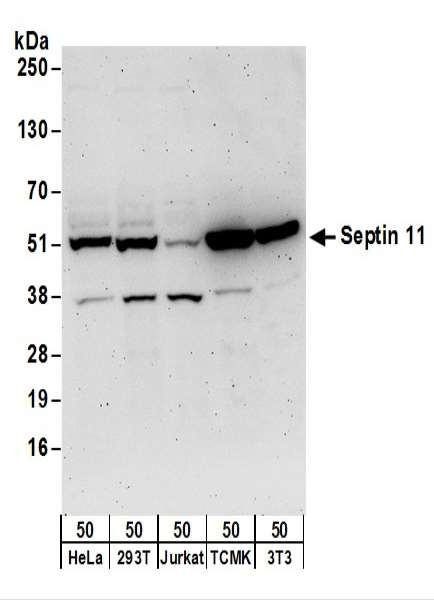 Anti-Septin 11