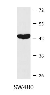 Anti-AHCY / Adenosylhomocysteinase