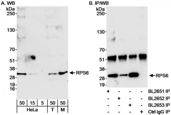 Anti-RPS6