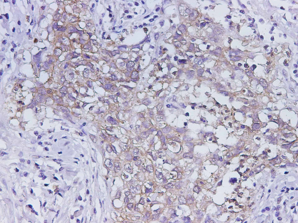 Anti-EpCAM