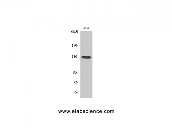 Anti-Phospho-JAK1 (Tyr1022)