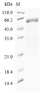 Syntenin-1 (SDCBP), partial, human, recombinant