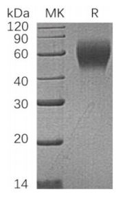 CD200 R1, His, Human