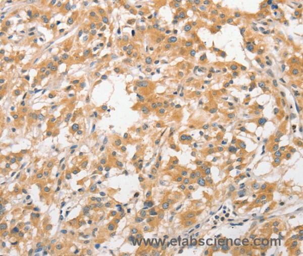 Anti-ANAPC5