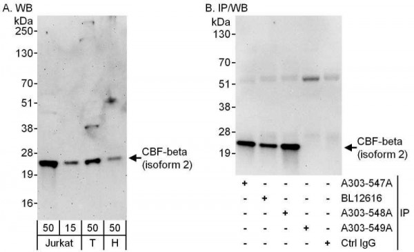 Anti-CBF-beta (isoform 2)