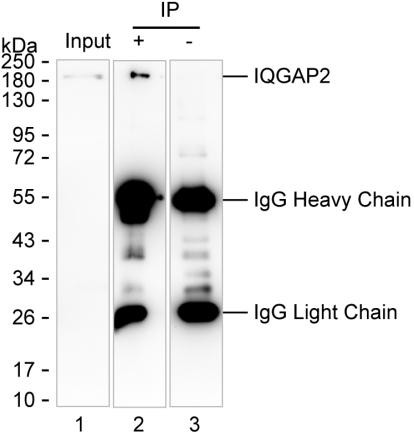 Anti-IQGAP2